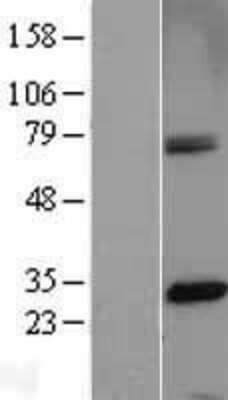 Western Blot: CENPH Overexpression Lysate [NBL1-09084]