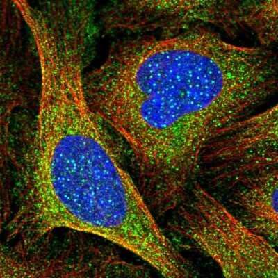 Immunocytochemistry/ Immunofluorescence: CENPI Antibody [NBP2-56199]