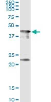 Immunoprecipitation: CENPJ Antibody (1A5) [H00055835-M02]