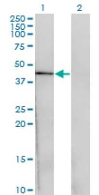 Western Blot: CENPJ Antibody (1A5) [H00055835-M02]