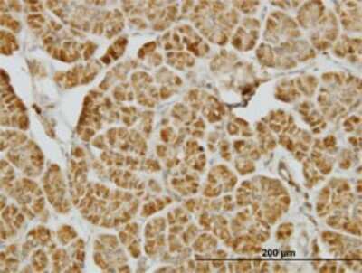 Immunohistochemistry-Paraffin: CENPJ Antibody (5D5) [H00055835-M01]