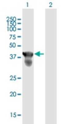 Western Blot: CENPJ Antibody [H00055835-B01P]