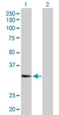 Western Blot: CENPJ Antibody [H00055835-D01P]