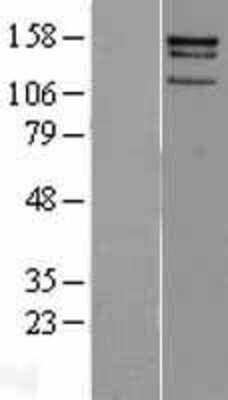 Western Blot: CENPJ Overexpression Lysate [NBL1-09085]