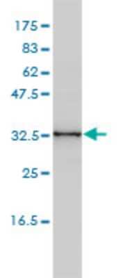 Western Blot: CENPK Antibody (1G2-1B10) [H00064105-M01]