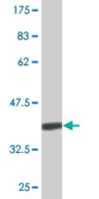 Western Blot: CENPK Antibody (4D11) [H00064105-M08]