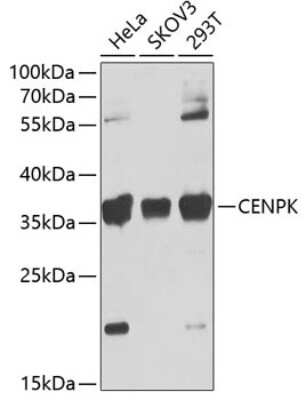 Western Blot: CENPK AntibodyBSA Free [NBP2-92676]