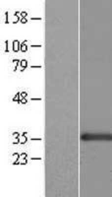 Western Blot: CENPK Overexpression Lysate [NBL1-09086]