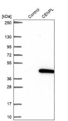 Western Blot: CENPL Antibody [NBP1-88485]