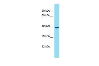 Western Blot: CENPL Antibody [NBP2-84650]