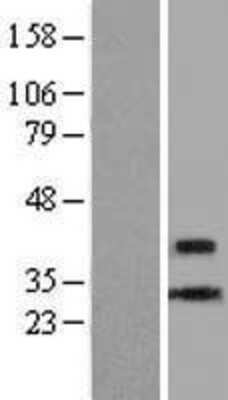 Western Blot: CENPL Overexpression Lysate [NBL1-09087]