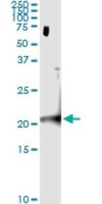 Immunoprecipitation: CENPM Antibody (4C12-2C8) [H00079019-M01]