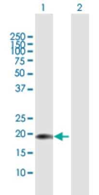 Western Blot: CENPM Antibody [H00079019-B01P]