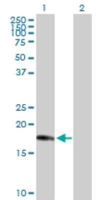 Western Blot: CENPM Antibody [H00079019-D01P]