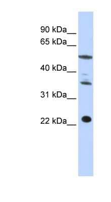 Western Blot: CENPM Antibody [NBP1-54361]