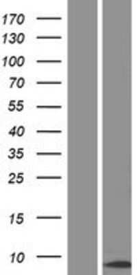 Western Blot: CENPM Overexpression Lysate [NBP2-09368]