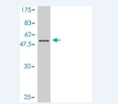 Western Blot: CENPN Antibody (4A5-1C11) [H00055839-M01]