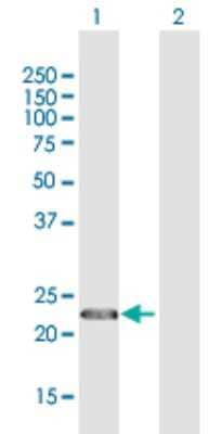 Western Blot: CENPN Antibody [H00055839-D01P]