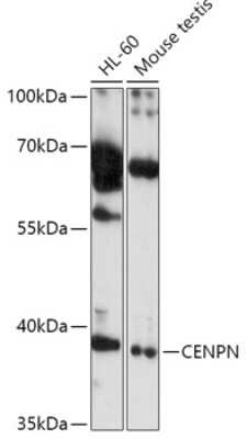 Western Blot: CENPN AntibodyAzide and BSA Free [NBP2-92377]