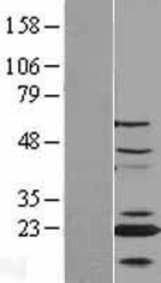 Western Blot: CENPN Overexpression Lysate [NBL1-09089]