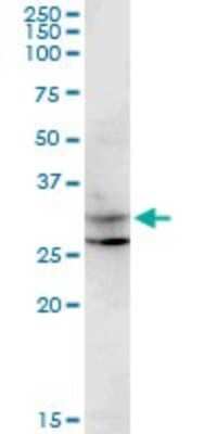 Western Blot: CENPP Antibody (3G8) [H00401541-M07]