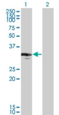Western Blot: CENPP Antibody (3G8) [H00401541-M07]