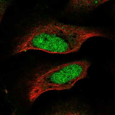 Immunocytochemistry/ Immunofluorescence: CENPP Antibody [NBP2-58596]