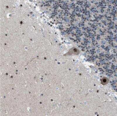 Immunohistochemistry-Paraffin: CENPP Antibody [NBP1-85688]