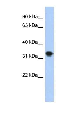 Western Blot: CENPP Antibody [NBP1-53064]