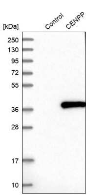 Western Blot: CENPP Antibody [NBP1-85688]