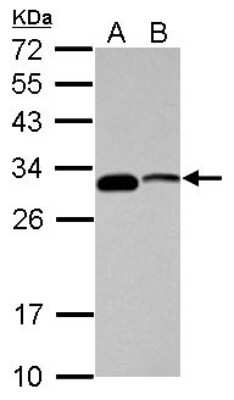 Western Blot: CENPP Antibody [NBP2-15859]