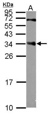 Western Blot: CENPP Antibody [NBP2-15859]