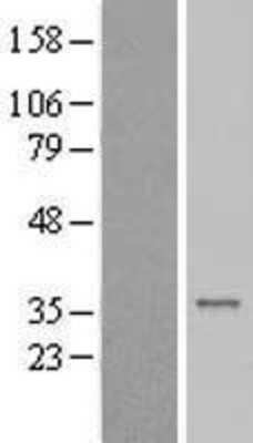 Western Blot: CENPP Overexpression Lysate [NBL1-09091]