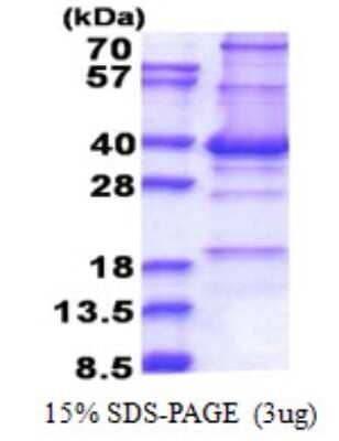 SDS-PAGE: Recombinant Human CENPP His Protein [NBP2-22767]