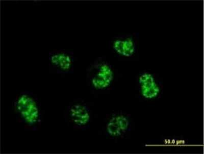 Immunocytochemistry/ Immunofluorescence: CENPQ Antibody (2B5-2D12) [H00055166-M01]