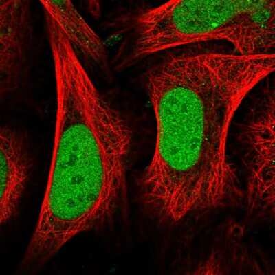 Immunocytochemistry/ Immunofluorescence: CENPQ Antibody [NBP2-58183]