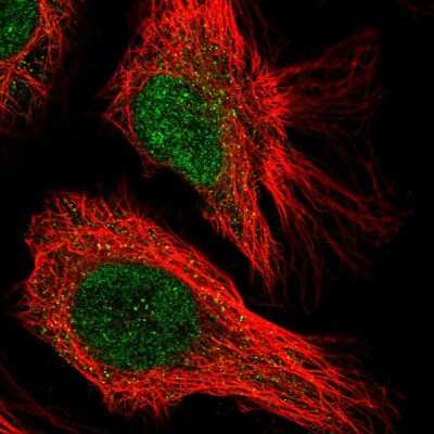 Immunocytochemistry/ Immunofluorescence: CENPQ Antibody [NBP2-58745]