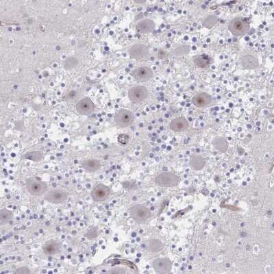Immunohistochemistry: CENPQ Antibody [NBP2-48851]