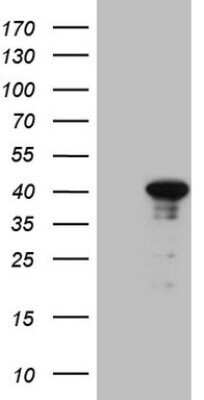 Western Blot: CENPQ Antibody (OTI1C5)Azide and BSA Free [NBP2-71991]