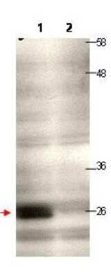 Western Blot: CENPQ Antibody [NBP1-42740]