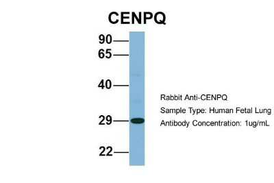 Western Blot: CENPQ Antibody [NBP1-55216]