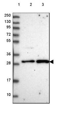 Western Blot: CENPQ Antibody [NBP2-48851]