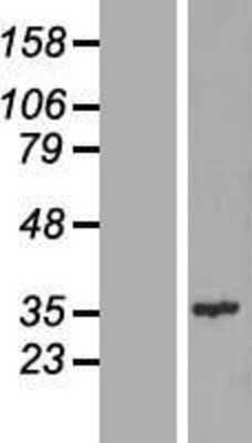 Western Blot: CENPQ Overexpression Lysate [NBL1-09092]