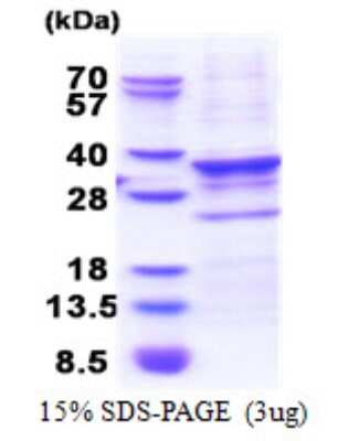 SDS-PAGE: Recombinant Human CENPQ His Protein [NBP2-22768]