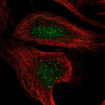 Immunocytochemistry/ Immunofluorescence: CENPT Antibody [NBP2-58946]