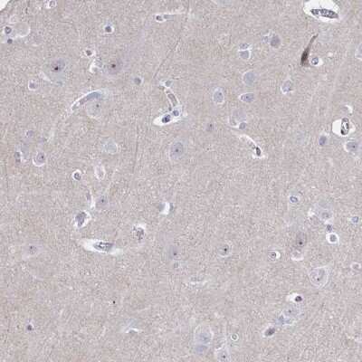 Immunohistochemistry-Paraffin: CENPT Antibody [NBP2-34093]