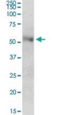 Western Blot: CENPT Antibody [H00080152-B01P]