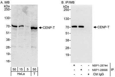 Western Blot: CENPT Antibody [NBP1-28744]