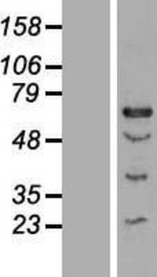 Western Blot: CENPT Overexpression Lysate [NBL1-09093]