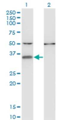 Western Blot: CENPV Antibody (1D9) [H00201161-M05]